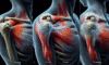 Acupuncture for Frozen Shoulder Relief Techniques