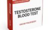 Testosterone Blood Tests: Essential for Guildford Residents