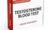 Testosterone Blood Test: A Vital Guide for Slough Residents